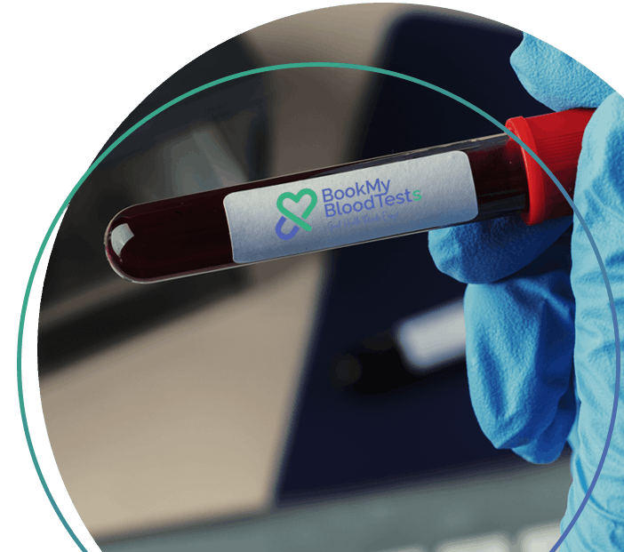 Fast, Reliable &  Hassle-Free  Blood Testing!